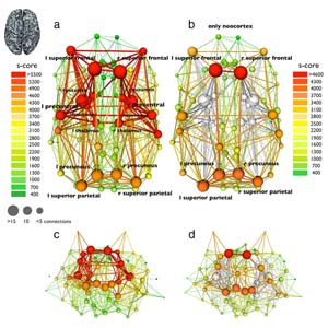 نقشه برداری مغزی | نقشه ی مغزی QEEG
